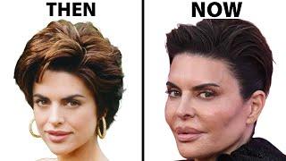 Lisa Rinna's NEW FACE | Plastic Surgery Analysis