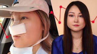 I Got Plastic Surgery And I Regret It