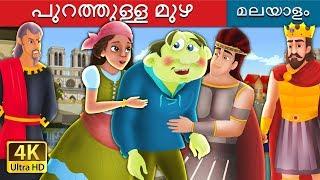 പുറത്തുള്ള മുഴ | The Hunchback Of Notre Dame Malayalam Cartoon | @MalayalamFairyTales