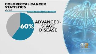 American Cancer Society: More young people have colorectal cancer