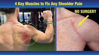 Fix Any Shoulder Pain with 4 Targeted Exercises - (COMPLETELY AVOID SURGERY!)