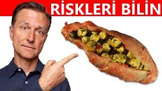 Safra Keseniz Risk Altında mı? Dikkat Etmeniz Gereken 12 Belirtisi | Dr.Berg Türkçe