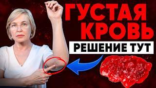 Разжижение крови — профилактика давления и варикоза. 3 простые точки