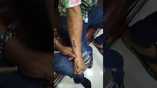 Tattoo remove in Bangladesh  new market dhaka 01857570576