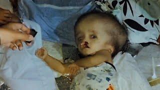 Baby na may Hydrocephalus at Cleft | BP Charity Ep.2 P1 | No Ads, Pure Charity.