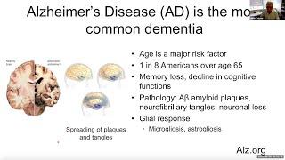 "Innate Immune Responses in Neurodegeneration" by Dr. Maco Colonna