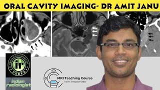 ORAL CAVITY IMAGING | DR AMIT JANU #oralcancer #mrineck