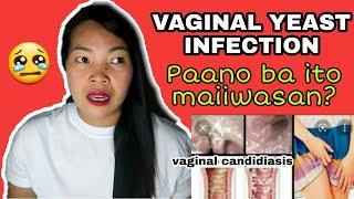 MAKATING PWERTA O ARI NG BABAE /VAGINAL YEAST INFECTION.HOW TO PREVENT YEAST INFECTION?