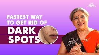 Best Ways To Lighten Your Dark Spots | Dr. Hansaji