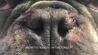 Stenotic Nares - before and after surgical correction