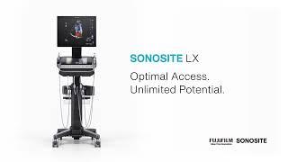 SONOSITE LX: Optimal Access. Unlimited Potential.