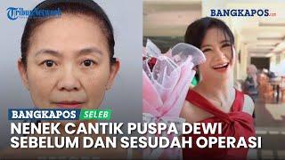 Nenek Cantik Puspa Dewi Lakukan Operasi Plastik, Ini Penampakan Sebelum dan Sesudah