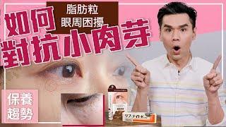 眼周保養困擾：如何對抗小肉芽？ ll Kevin想得美 ll Skincare Problem - How to Treat & Prevent Milia