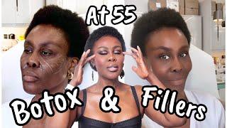 MY BATTLE WITH KELOIDS + GETTING THEM REMOVED | & HAVING BOTOX & FILLER FOR THE FIRST TIME AT 55! 