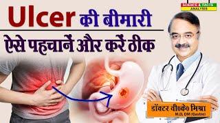 Ulcer की बीमारी ऐसे पहचानें और करें ठीक || STOMACH ULCERS