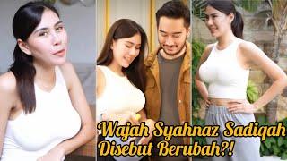 Wow Wajah Syahnaz Sadiqah Disebut Berubah, Makin Besar & Hot, yuk Intip Potret Perubahannya.