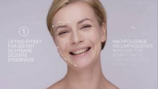 Fadenlifting – Sanftes Facelifting in der Sophienklinik mit Fäden von Silhouette™