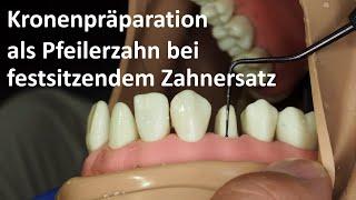 Kronenpräparation II: Kronenpräparation als Pfeilerzahn bei festsitzendem Zahnersatz [4K]