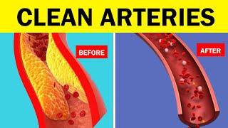 Top 10 Foods to Clean Arteries and  Prevent Heart Attacks Naturally