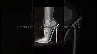 She was forced to wear heels at the age of 14#zendaya #lawroach #fashion#heels