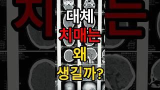 치매는 왜 생기는 걸까? #치매 #치매예방 #치매음식