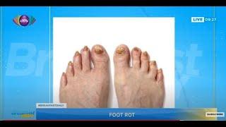 Foot rot: Causes, prevention and treatment | Breakfast Daily