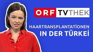 ORF TV THEK | Hair Transplantation in Turkey with İstanbul Vita