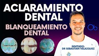 Aclaramiento Dental  Blanqueamiento Dental con Dr Sebastian Velazquez