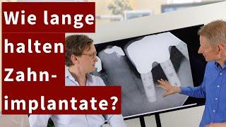 Wie lange halten Zahnimplantate? - aus unserer Zahnarztpraxis in Potsdam