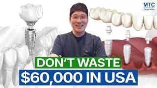 Why Get Dental Implants in Seoul? Top Implantologist in South Korea is Here to Explain!