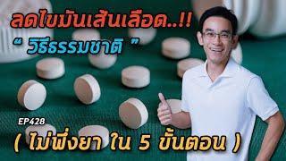 ลดไขมันในเส้นเลือด วิธีธรรมชาติ ไม่พึ่งยา ใน 5 ขั้นตอน  EP428