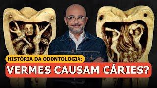 História da Odontologia: Cáries Causadas por Vermes?