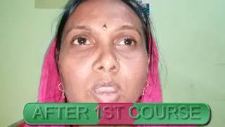 TREATMENT OF COLOR  BLINDNESSRETINITIS PIGMENTOSA -- D.R RISHABH JAIN +919425092329