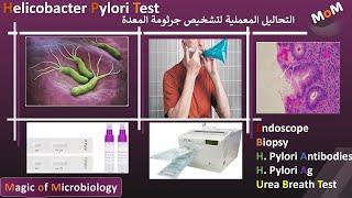 اعراض الاصابة بجرثومة المعدة واذاى اشخصها وافهم النتائج H.Pylori Test