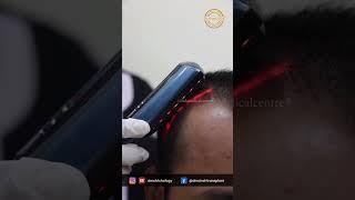 DMC - Root Restore Therapy ®️ For Hair Fall | #hairfallcontrol   #Shorts #youtubeshorts