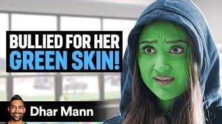 GIRL BULLIED For Her GREEN SKIN! | Dhar Mann Studios