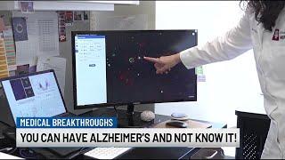 You can have Alzheimer’s and not know it