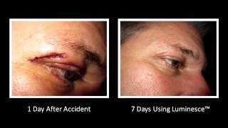 Jeunesse Global LUMINESCE Before & After Photos