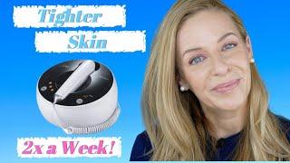 Skin Tightening | At Home Radio Frequency Device | Mlay | Mature Beauty | No Botox