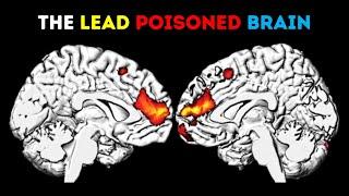 How Lead Made America Dumb!