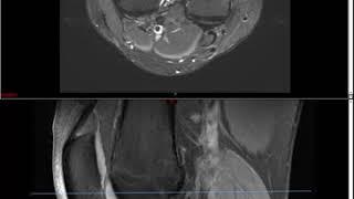 Knee MRI (Approach to MSK MRI Series)