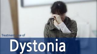 Generalized spasmodic dystonia / Spasmodic Torticollis  / Dystonia /  사경증 치료사례 / 근긴장이상증