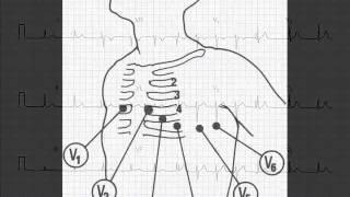 Master the basic steps of ECG (EKG) interpretation - Session 1