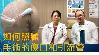 出院後如何照顧手術的傷口和引流管 How to manage postoperative wound and drains