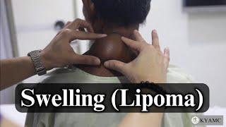 Examination of a Swelling ( Lipoma ) | Standardized Clinical Examination Videos | KYAMC