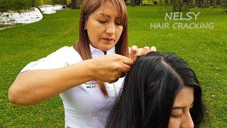 NELSY SPECIAL, 18 MINUTES HAIR CRACKING (Sacar los soles), ASMR, Alfredo Uno