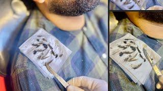 How to make your skin like actors, smooth and clear skin