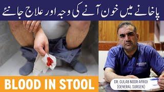 BLEEDING PER RECTUM In Urdu - Pakhane Men Khoon Aane Ki Wajah - Blood In Stool Causes & Treatment