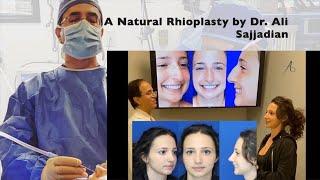 Female Rhinoplasty | Prominent nose |  | Natural nose| Dr. Ali Sajjadian