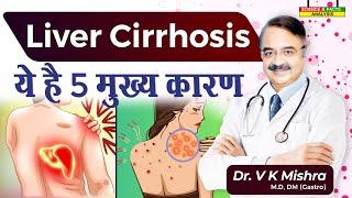 Liver Cirrhosis ये है 5 मुख्य कारण || CIRRHOSIS OF LIVER